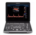 УЗИ аппарат Mindray Z60 Exp