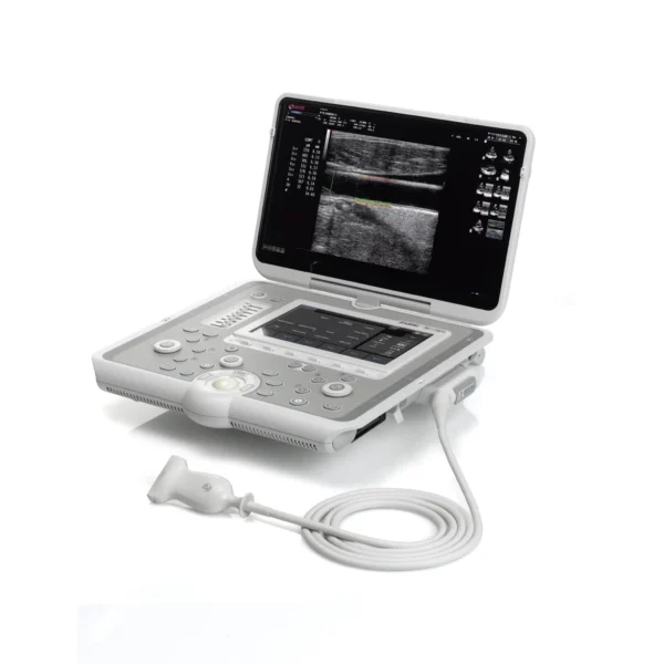 Esaote MyLab Sigma