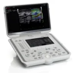 Esaote MyLab Omega