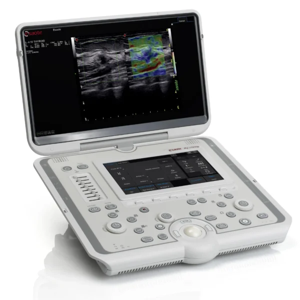Esaote MyLab Omega