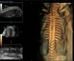 Клиническое изображение УЗИ-аппарат Mindray Resona 7_ Позвоночник эмбриона, 3D