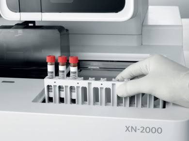Sysmex XN-2000